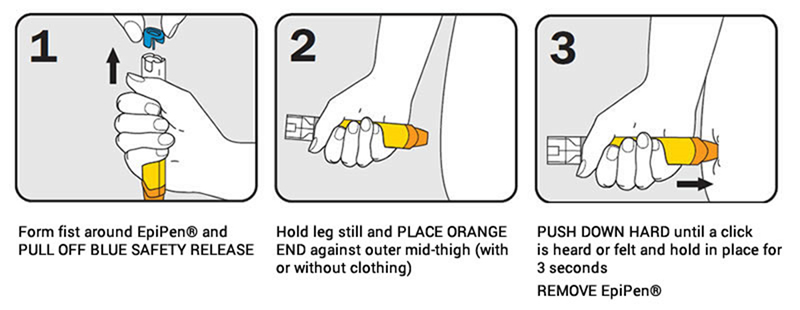 New epipen guidelines · radiate